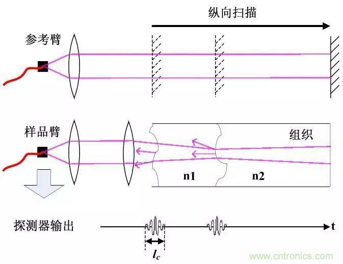 解讀光學(xué)相干層析成像技術(shù)