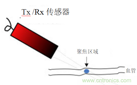 超聲系統(tǒng)的信號鏈設計注意事項